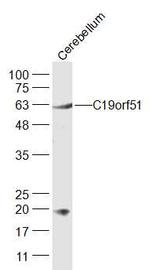 DNAAF3 Antibody in Western Blot (WB)