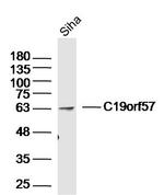 C19orf57 Antibody in Western Blot (WB)