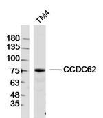 CCDC62 Antibody in Western Blot (WB)