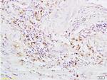 GPR30 Antibody in Immunohistochemistry (Paraffin) (IHC (P))