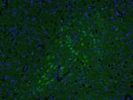 AKAP12/Gravin Antibody in Immunohistochemistry (Paraffin) (IHC (P))