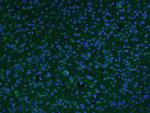 AKAP12/Gravin Antibody in Immunohistochemistry (Paraffin) (IHC (P))