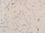 AKAP12/Gravin Antibody in Immunohistochemistry (Paraffin) (IHC (P))