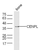 CENPL Antibody in Western Blot (WB)