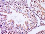Centrin 2 Antibody in Immunohistochemistry (Paraffin) (IHC (P))