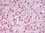 Centrin 2 Antibody in Immunohistochemistry (Paraffin) (IHC (P))
