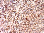 CEP192 Antibody in Immunohistochemistry (Paraffin) (IHC (P))