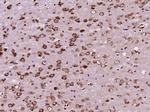 CEP290 Antibody in Immunohistochemistry (Paraffin) (IHC (P))