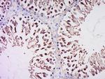 CEP70 Antibody in Immunohistochemistry (Paraffin) (IHC (P))