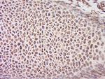 CEP70 Antibody in Immunohistochemistry (Paraffin) (IHC (P))