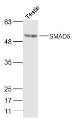 SMAD5 Antibody in Western Blot (WB)