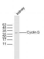 Cyclin G Antibody in Western Blot (WB)