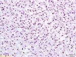 CHK2 Antibody in Immunohistochemistry (Paraffin) (IHC (P))