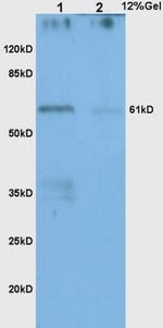 CHK2 Antibody in Western Blot (WB)