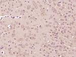 CHST7 Antibody in Immunohistochemistry (Paraffin) (IHC (P))