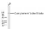 Complement factor 8 beta Antibody in Western Blot (WB)