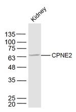 CPNE2 Antibody in Western Blot (WB)