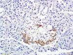 SREBP-1/2 Antibody in Immunohistochemistry (Paraffin) (IHC (P))