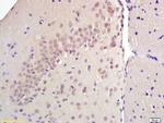SREBP-1/2 Antibody in Immunohistochemistry (Paraffin) (IHC (P))
