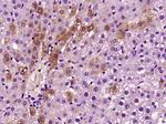 CPS1 Antibody in Immunohistochemistry (Paraffin) (IHC (P))