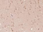 CRB1 Antibody in Immunohistochemistry (Paraffin) (IHC (P))