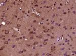 CRB2 Antibody in Immunohistochemistry (Paraffin) (IHC (P))