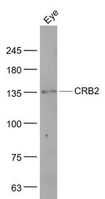 CRB2 Antibody in Western Blot (WB)