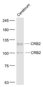 CRB2 Antibody in Western Blot (WB)