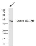 CKMT1A/B + CKMT2 + CKB + CKM Antibody in Western Blot (WB)