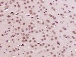 CREB5 Antibody in Immunohistochemistry (Paraffin) (IHC (P))