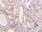 HNF1A Antibody in Immunohistochemistry (Paraffin) (IHC (P))