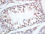 CRNKL1 Antibody in Immunohistochemistry (Paraffin) (IHC (P))