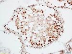 CRNKL1 Antibody in Immunohistochemistry (Paraffin) (IHC (P))