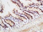 CRNKL1 Antibody in Immunohistochemistry (Paraffin) (IHC (P))