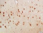 LUC7L3 Antibody in Immunohistochemistry (Paraffin) (IHC (P))