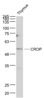 LUC7L3 Antibody in Western Blot (WB)