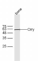 Crry Antibody in Western Blot (WB)