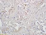 H-1 beta Antibody in Immunohistochemistry (Paraffin) (IHC (P))