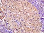 CTDSP2 Antibody in Immunohistochemistry (Paraffin) (IHC (P))