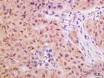 CTDSP2 Antibody in Immunohistochemistry (Paraffin) (IHC (P))