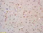 HSTF2 Antibody in Immunohistochemistry (Paraffin) (IHC (P))