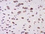 CTTNBP2NL Antibody in Immunohistochemistry (Paraffin) (IHC (P))