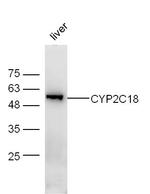 CYP2C18 Antibody in Western Blot (WB)