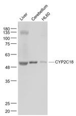 CYP2C18 Antibody in Western Blot (WB)