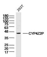 CYP4Z2P Antibody in Western Blot (WB)