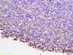 NFAT2 Antibody in Immunohistochemistry (Paraffin) (IHC (P))