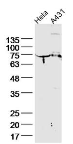 Cytokeratin 2e Antibody in Western Blot (WB)