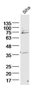 Cytokeratin 2e Antibody in Western Blot (WB)