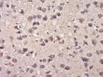 Phospho-delta 1 Catenin (Tyr280) Antibody in Immunohistochemistry (Paraffin) (IHC (P))