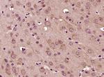 MADD Antibody in Immunohistochemistry (Paraffin) (IHC (P))